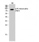 PI 3-kinase p85α (phospho Tyr607) Polyclonal Antibody