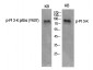 PI 3-kinase p85α (phospho Tyr607) Polyclonal Antibody