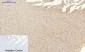 PI 3-kinase p85α (phospho Tyr607) Polyclonal Antibody