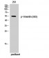 Vimentin (phospho Ser83) Polyclonal Antibody