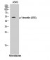 Vimentin (phospho Ser56) Polyclonal Antibody