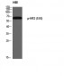 NF2 (phospho Ser10) Polyclonal Antibody