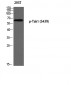 Tak1 (phospho Ser439) Polyclonal Antibody