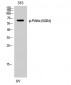 PAKα (phospho Ser204) Polyclonal Antibody