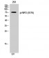 RIP2 (phospho Ser176) Polyclonal Antibody