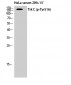 Trk C (phospho Tyr516) Polyclonal Antibody