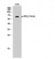 FRS2 (phospho Tyr436) Polyclonal Antibody