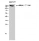 NMDAε2 (phospho Tyr1336) Polyclonal Antibody