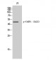 CtBP1 (phospho Ser422) Polyclonal Antibody