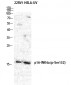 p16 (phospho Ser326) Polyclonal Antibody