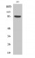 Cortactin (phospho Tyr466) Polyclonal Antibody