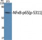 NFκB-p65 (phospho Ser311) Polyclonal Antibody