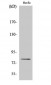 PKC δ (phospho Ser645) Polyclonal Antibody