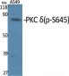 PKC δ (phospho Ser645) Polyclonal Antibody