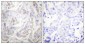 Cytokeratin 18 (phospho Ser33) Polyclonal Antibody