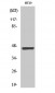 Cytokeratin 18 (phospho Ser33) Polyclonal Antibody