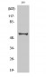 c-Myc (phospho Ser62) Polyclonal Antibody