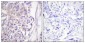 Cot (phospho Thr290) Polyclonal Antibody