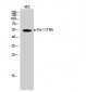 Ets-1 (phospho Thr38) Polyclonal Antibody