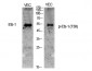 Ets-1 (phospho Thr38) Polyclonal Antibody