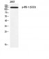 IRS-1 (phospho Ser323) Polyclonal Antibody