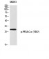 PP2A-Cα (phospho Tyr307) Polyclonal Antibody