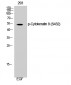 Cytokeratin 8 (phospho Ser432) Polyclonal Antibody