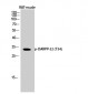 DARPP-32 (phospho Thr34) Polyclonal Antibody