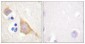MOR-1 (phospho Ser375) Polyclonal Antibody