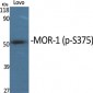 MOR-1 (phospho Ser375) Polyclonal Antibody