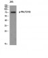 Plk (phospho Thr210) Polyclonal Antibody