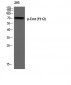 Emt (phospho Tyr512) Polyclonal Antibody