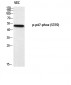 p47-phox (phospho Ser370) Polyclonal Antibody