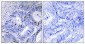 Presenilin 2 (phospho Ser330) Polyclonal Antibody