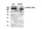 PERK (phospho Thr981) Polyclonal Antibody