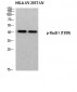 Rad51 (phospho Thr309) Polyclonal Antibody