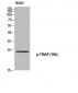TIRAP (phospho Tyr86) Polyclonal Antibody