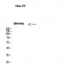 mTOR (phospho Ser2481) Polyclonal Antibody