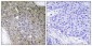 TGFβ RIII (phospho Thr842) Polyclonal Antibody