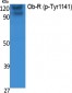 Ob-R (phospho Tyr1141) Polyclonal Antibody