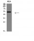 p53(Phospho-Ser366) Polyclonal Antibody