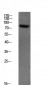 SYK (Phospho-Tyr348) Antibody