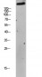 mTOR (Phospho-Ser2448) Antibody