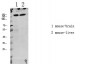 LATS1/2 (Phospho-Thr1079/1041) Antibody