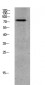 GRK2 (Phospho-Ser685) Antibody