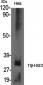 11β-HSD1 Polyclonal Antibody