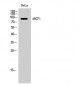 ABCF1 Polyclonal Antibody