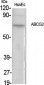 ABCG2 Polyclonal Antibody