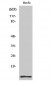 ACBP Polyclonal Antibody