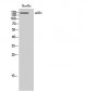 ACE1 Polyclonal Antibody